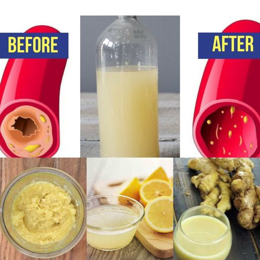 Only a Glass of This Juice Will Remove Clogged Arteries and Control Blood Pressure: Ginger, Lemon, and Garlic Juice