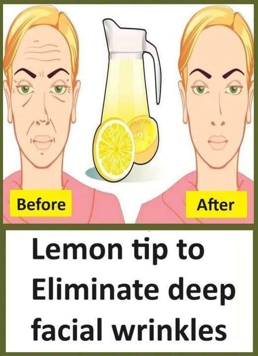 Advice for reducing severe facial wrinkles using lemon