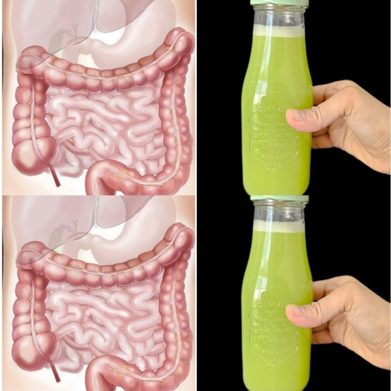 Intestine and Liver Are Like New! Only 3 Days – All the Dirt Comes Out with Green Juice