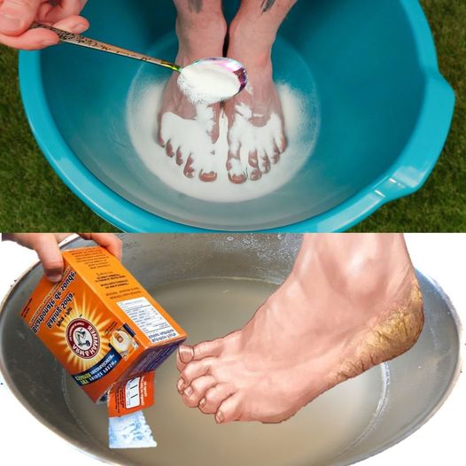 I Put Baking Soda on My Feet and Look What Happened! Works Like Magic