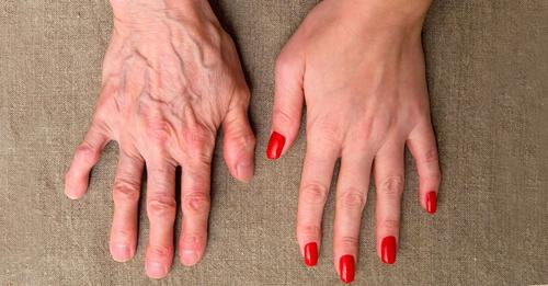 Anti-wrinkle treatments to rejuvenate hands after age 40