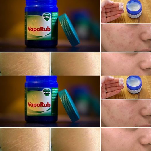 8 Surprising Uses of Vicks VapoRub