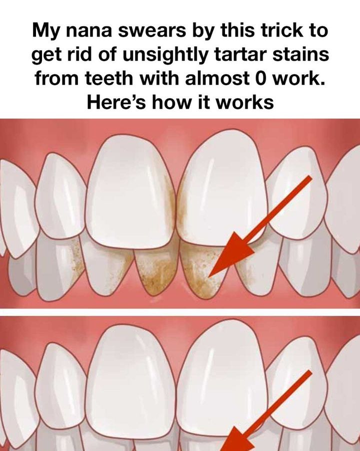 Maintaining good dental hygiene is essential not just for a bright smile, but for your overall health.