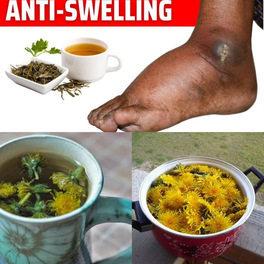 Goodbye Swollen Legs and Ankles: The Healing Power of Parsley Tea and More