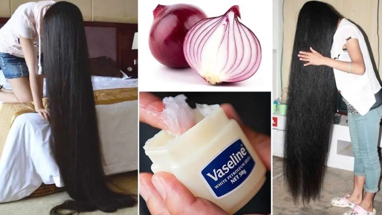 Boost Your Hair Growth with Vaseline and Onion: A Simple Home Remedy