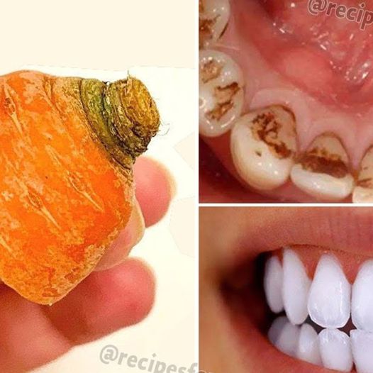 Transform Your Smile Naturally: Carrot Tops for Brilliant White Teeth in Just 2 Minutes!