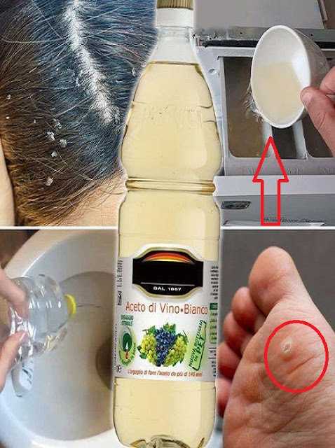 11 strange and very useful uses of vinegar See the first comment for details. · ·