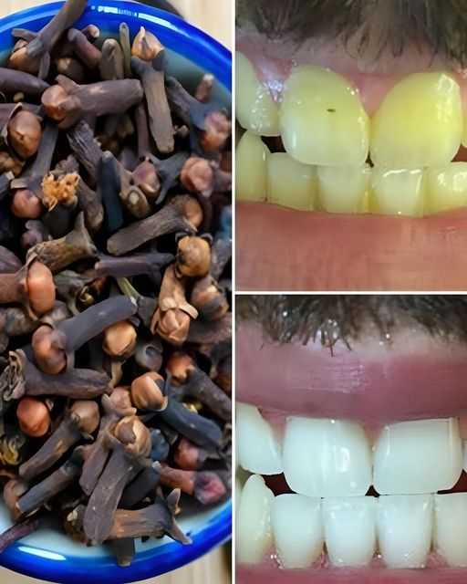 DIY Teeth-Whitening Paste: A Natural Solution for a Brighter Smile