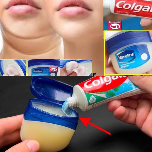 Vaseline and Toothpaste: I Didn’t Expect It to Have Such a Magical Effect! Solving Troubles Instantly