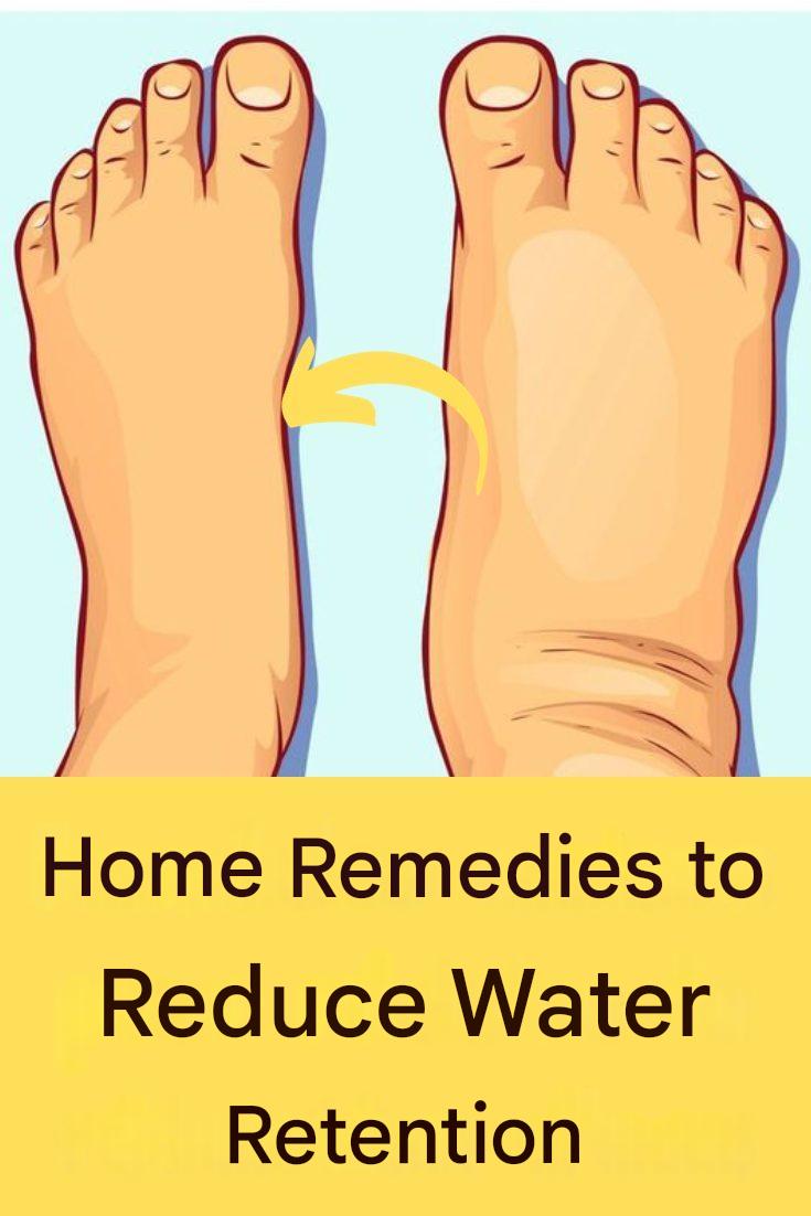 Edema: 10 home remedies to reduce water retention!!