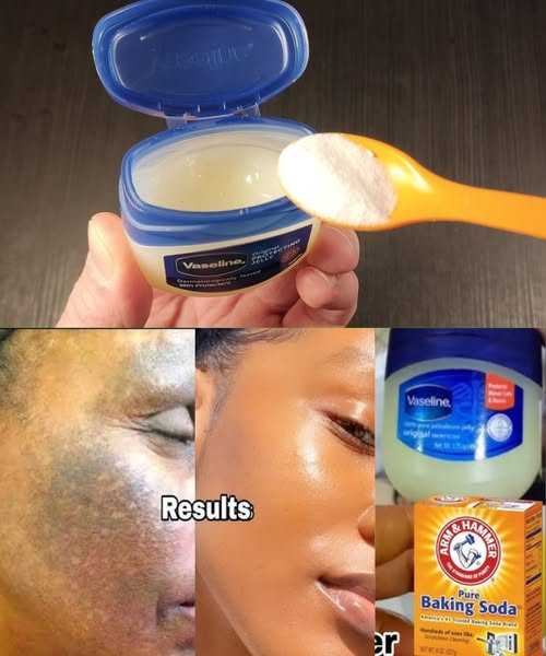 Combine Baking Soda with Vaseline: The 2-Minute Miracle Solution!