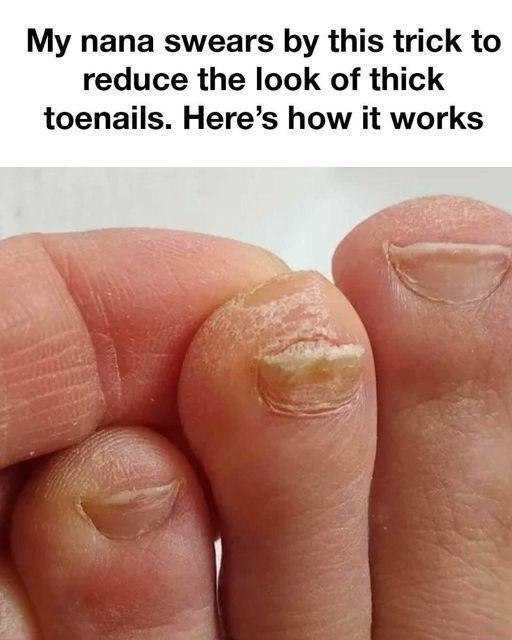 My nana swears by this trick to reduce the look of thick toenails. Here’s how it works