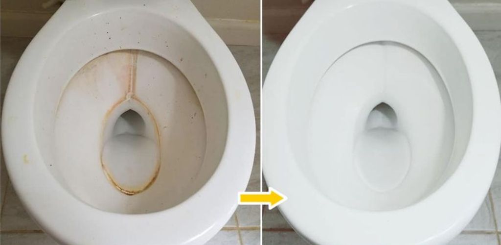 Very clean toilets: how to prepare a cleaner that removes limescale and makes it shine