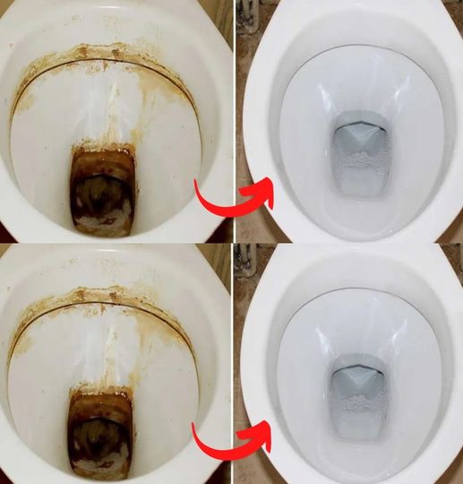 The unpleasant tartar in the toilet disappears with this amazing ingredient