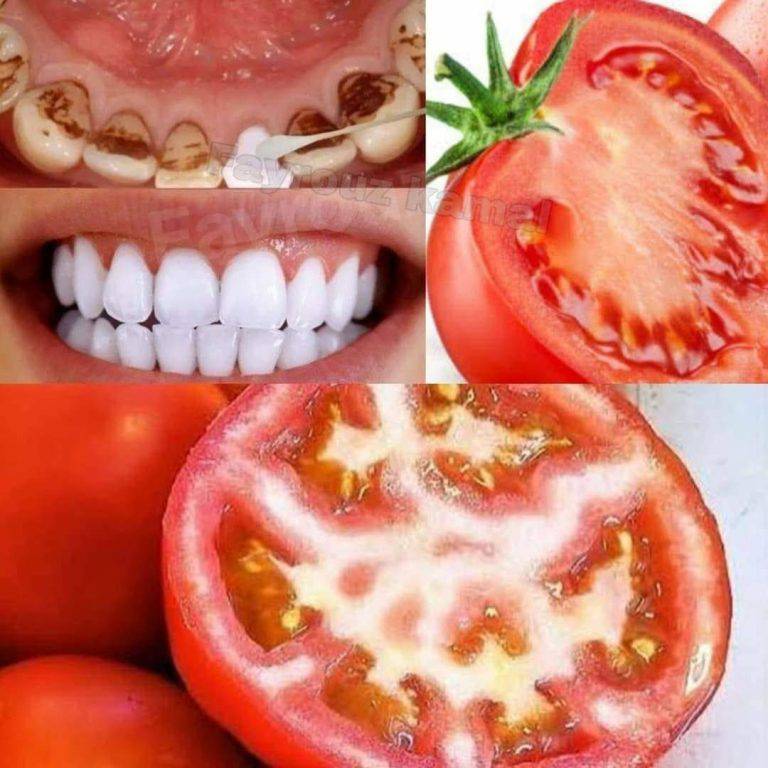 Brighten Your Smile Naturally: Tomato Teeth Whitening…