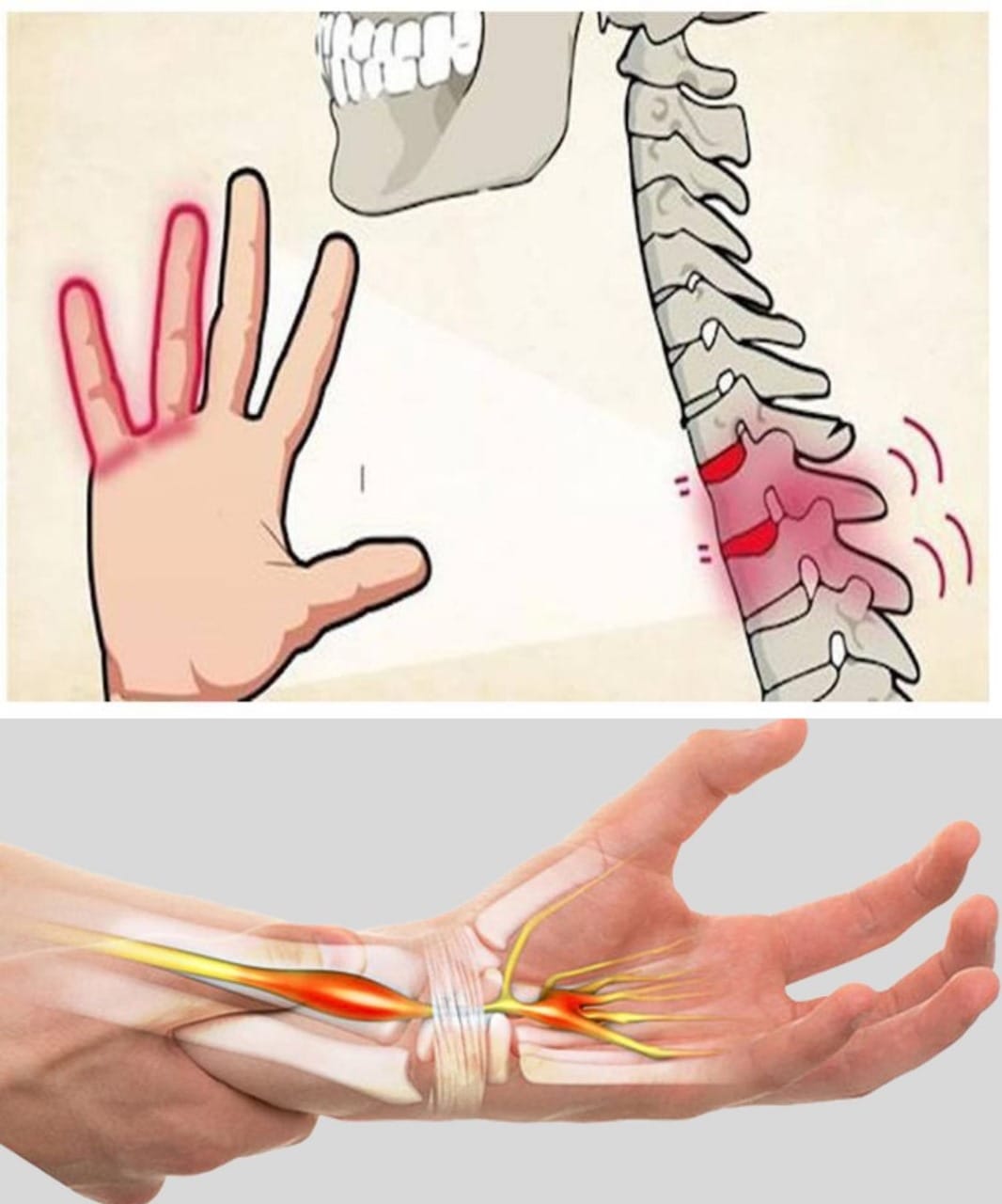 What Your Body is Trying to Tell You When You Feel Numbness in Your Hands