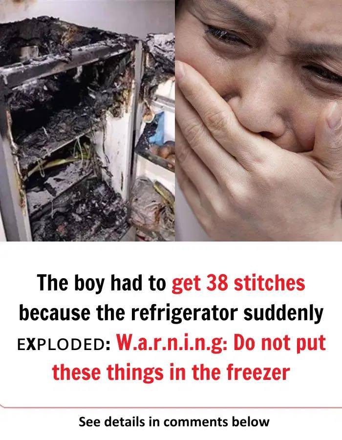 The boy had to get 38 stitches because the refrigerator suddenly ᴇxᴘʟᴏᴅᴇᴅ: W.a.r.n.i.n.g: Do not put these things in the freezer