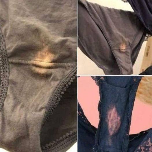 If you find a “bleach stain” in your underwear, you better know what it means