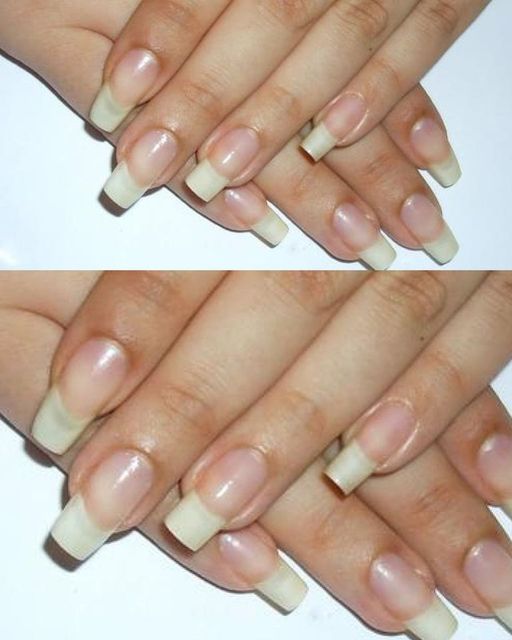 For nails that are fragile, a natural and handmade therapy that hardens them