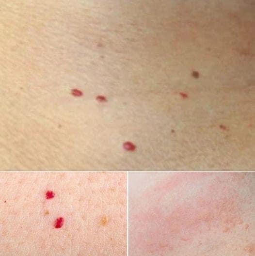 Red dots on your skin: Causes and what they could mean