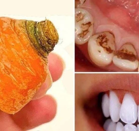 Carrot tops whiten teeth naturally, which is the key to a better smile.