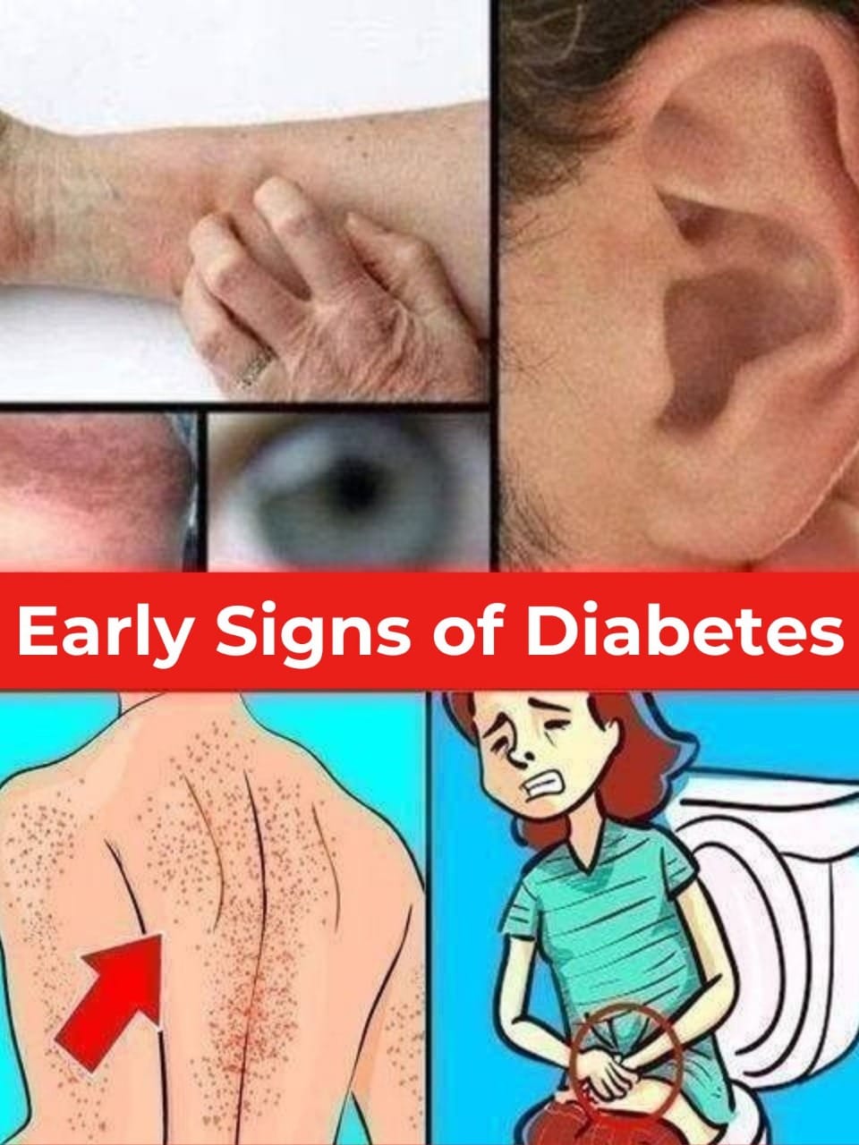 From Head to Toe: How to Recognize All the Signs of Diabetes