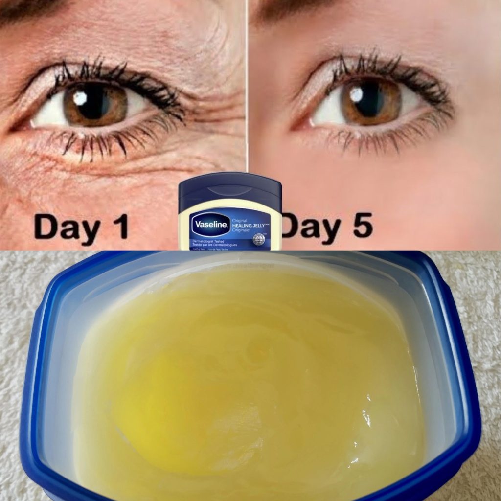 The Power of Vaseline to Remove Wrinkles! Look 20 Years Younger Naturally