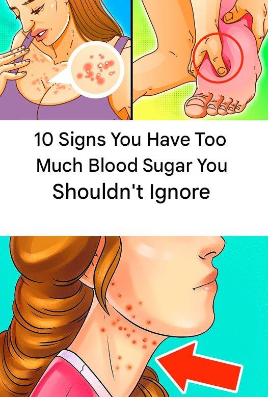 10 Signs You’re Eating Too Much Sugar