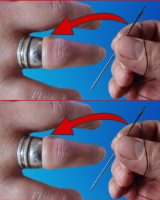 How to Easily Remove a Stuck Ring from Your Finger with a Needle