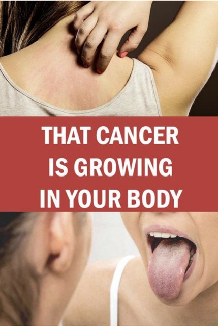 19 Warning signs that cancer is growing in your body