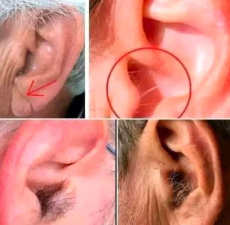 Did you know that if your ear hairs grow, it is because your body is