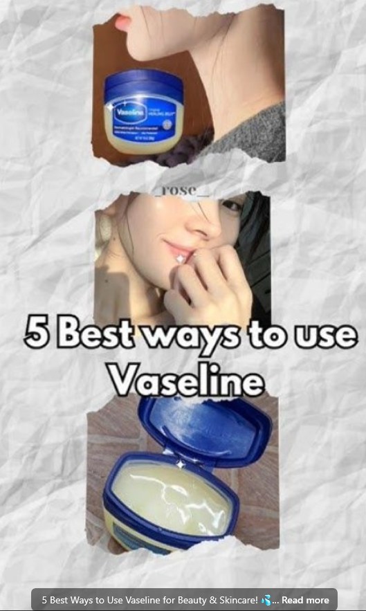 5 Best Ways to Use Vaseline for Beauty & Skincare!