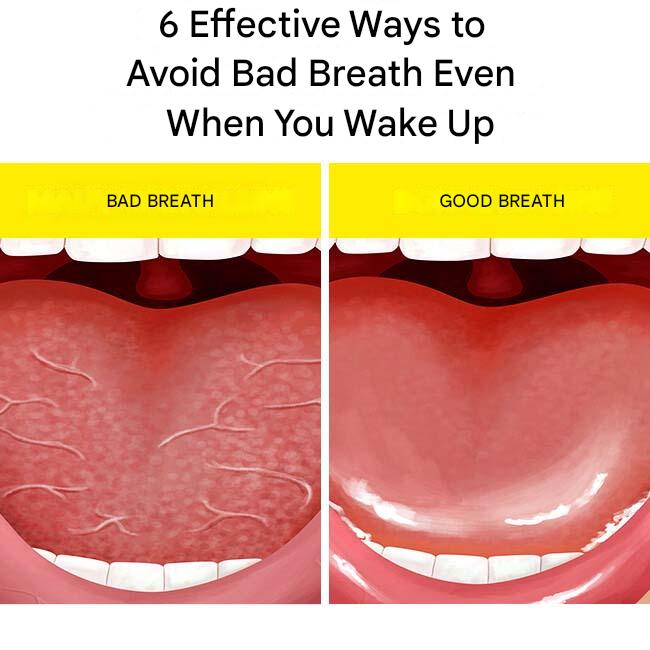 6 Ways to Avoid Bad Breath Even When You Wake Up