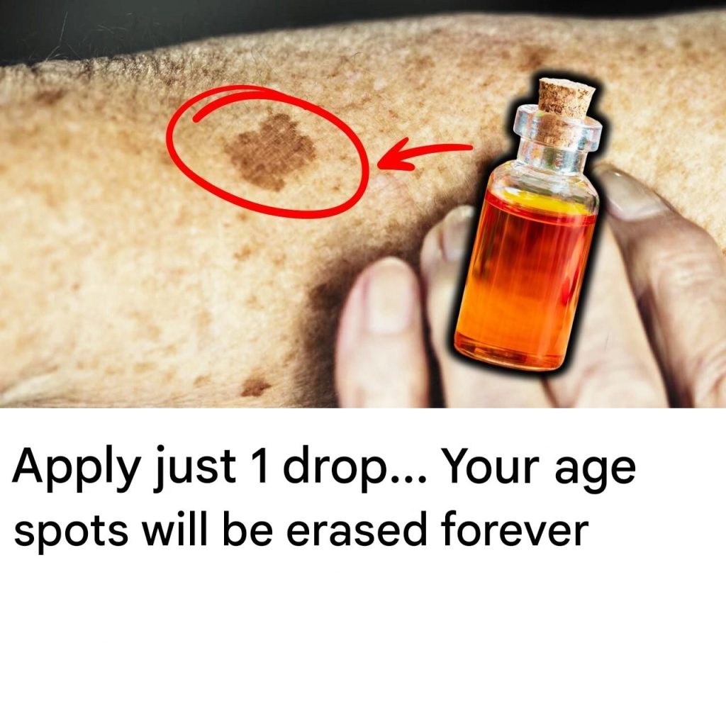 Apply just 1 drop… Your age spots will be erased forever