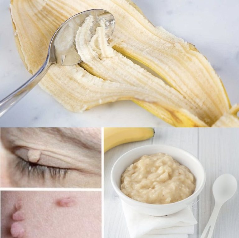 Unlocking the Secret: Banana Peel for Ageless Beauty – A Centuries-Old Recipe!