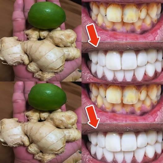 How to whiten teeth with lemon and ginger?