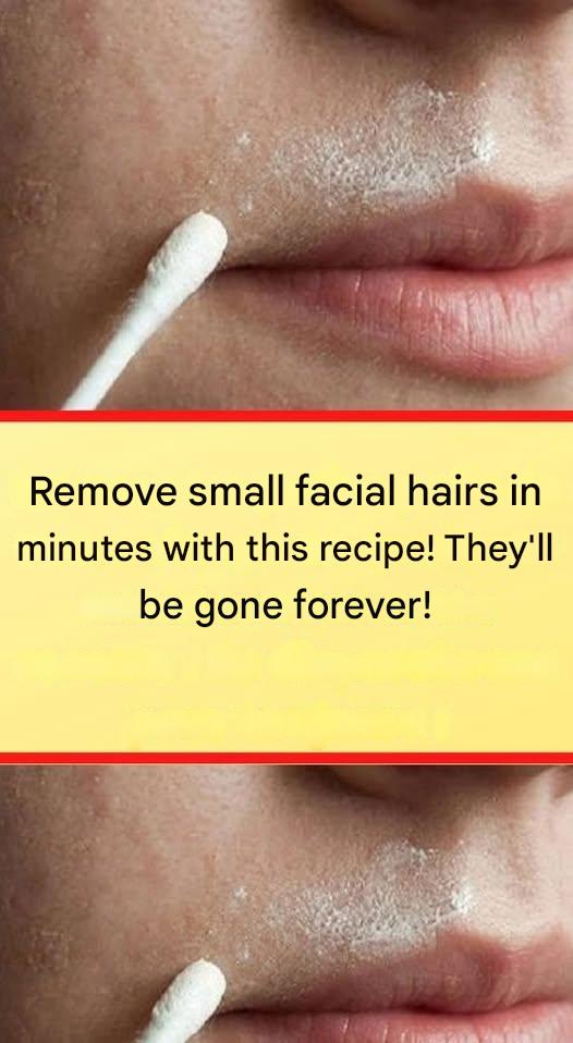 This natural recipe will permanently remove facial hair