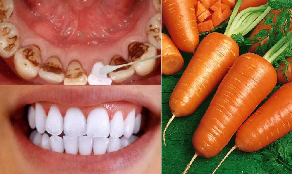 Teeth Whitening in Just 2 Minutes – Turn Yellowing and Tartar Buildup into Shiny Milky White with Carrot Tops!