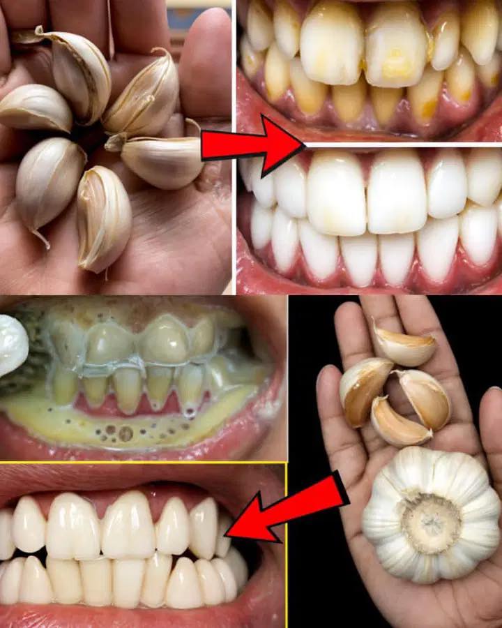 The natural secret to whiter teeth…