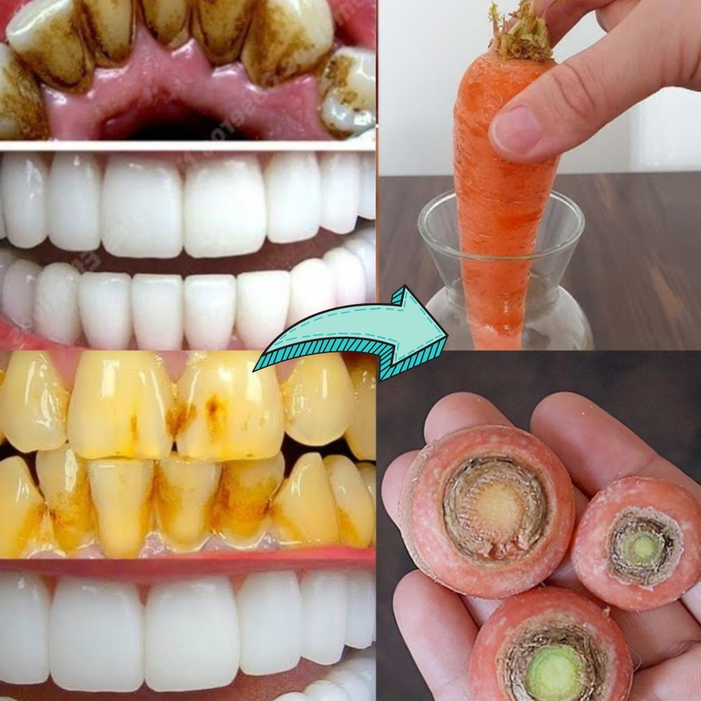 Whiten Your Teeth Naturally with Carrot Tops (Yes, Really!)