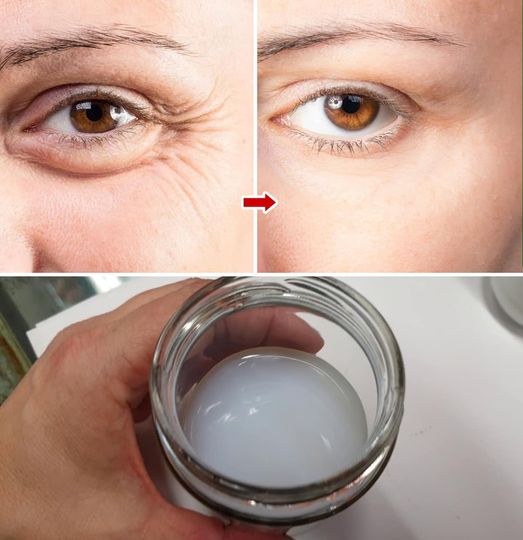 How to use coconut oil against wrinkles, blackheads and skin spots