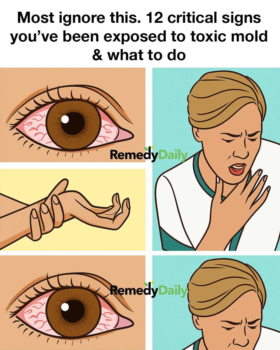 Most ignore this. 12 critical signs you’ve been exposed to toxic mold & what to do