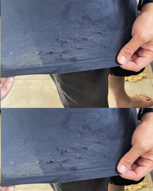 What causes these holes in my husbands t-shirts?