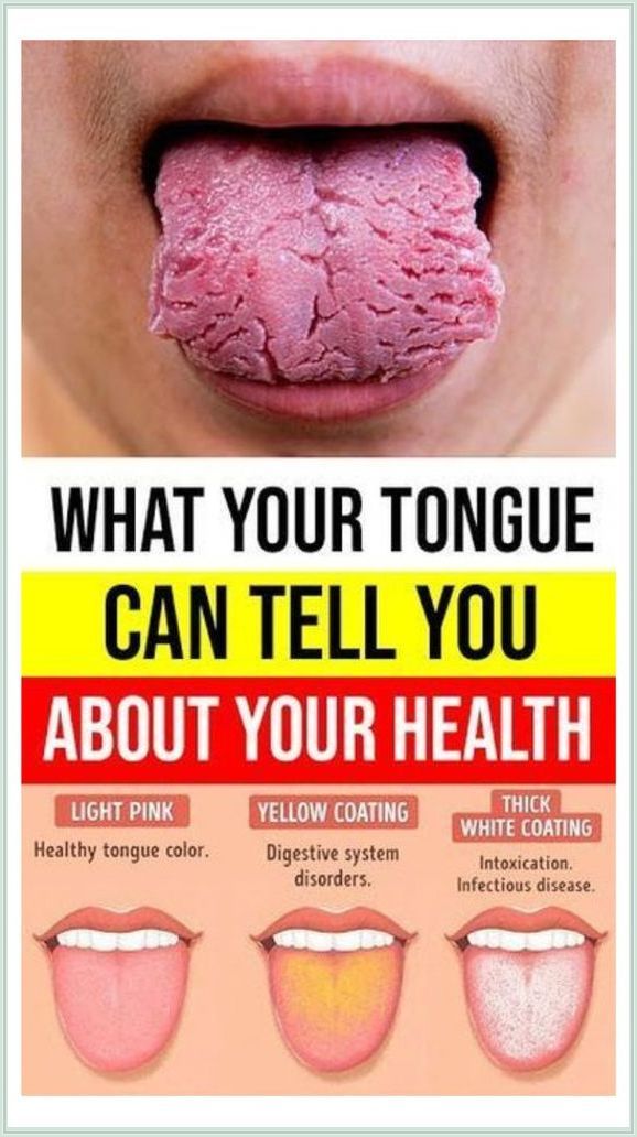 What Your Tongue is Trying to Tell You About Your